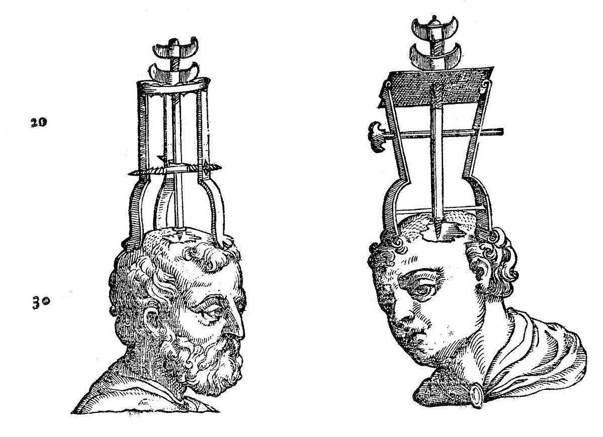 Instrumenti za trepanaciju, 1573. Wellcome Library, London. See page for author, CC BY 4.0, via Wikimedia Commons