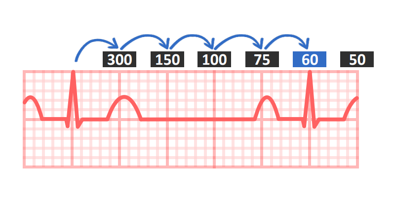 ekg: Određivanje frekvence kod pravilnog ritma