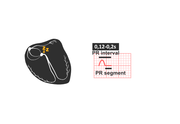 ekg: PR interval, PR segment