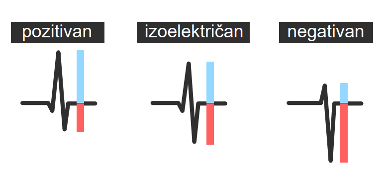 tipovi QRS kompleksa