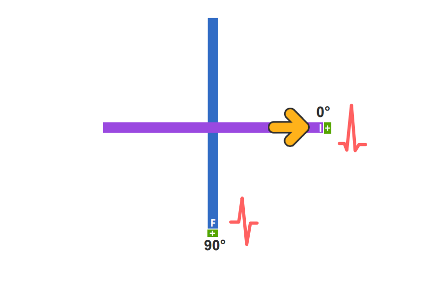 ekg: Osovina srca iznosi 0 stepeni
