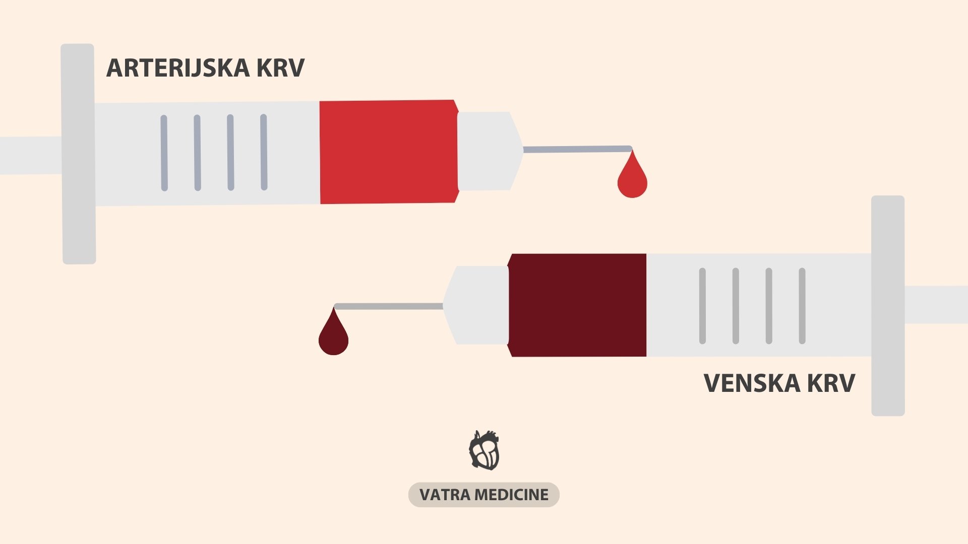 Arterijska i venska boja krvi.Šta znači tamna boja krvi iz vene pri vađenju, je li to normalno?