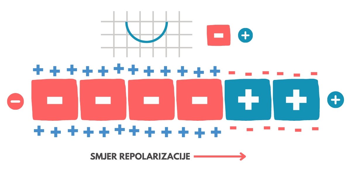 EKG, repolarizacija ćelija